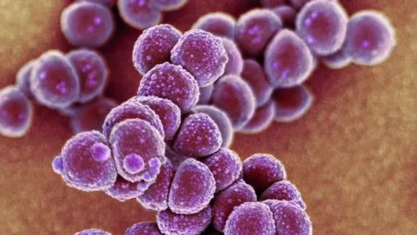 MRSA (Methicillin-resistant *Staphylococcus aureus*) is a notorious 'superbug' that has developed re